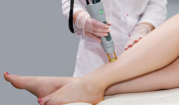 How Much Laser Hair Removal Cost for Legs