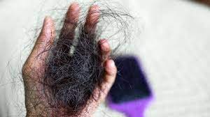 What Causes Most Hair Loss